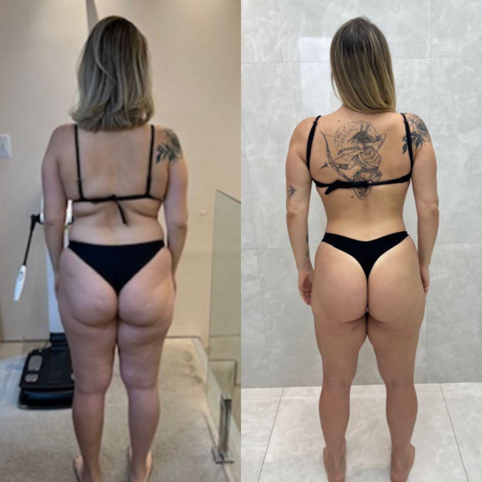 Resultado Paciente 2