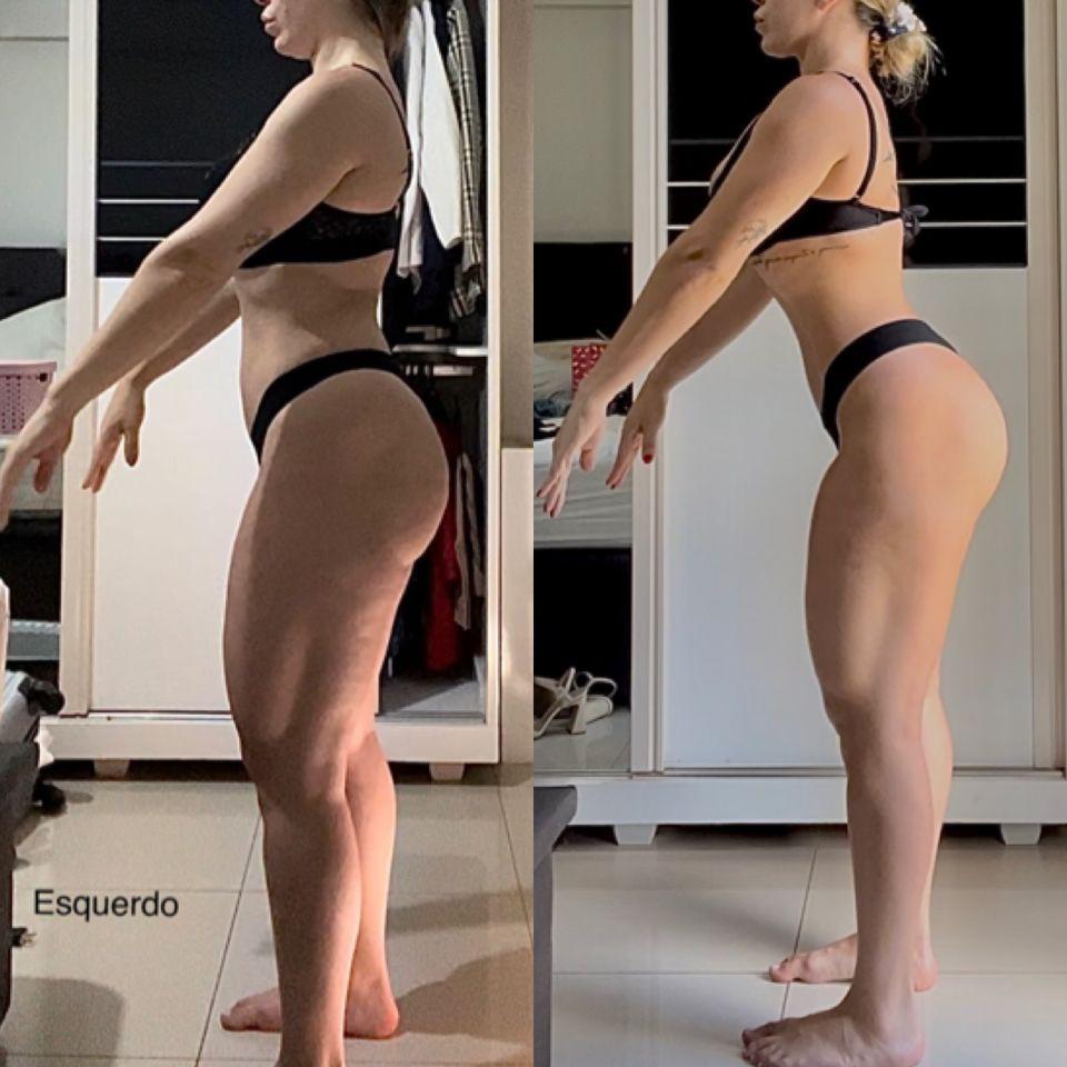 Resultado Paciente 3