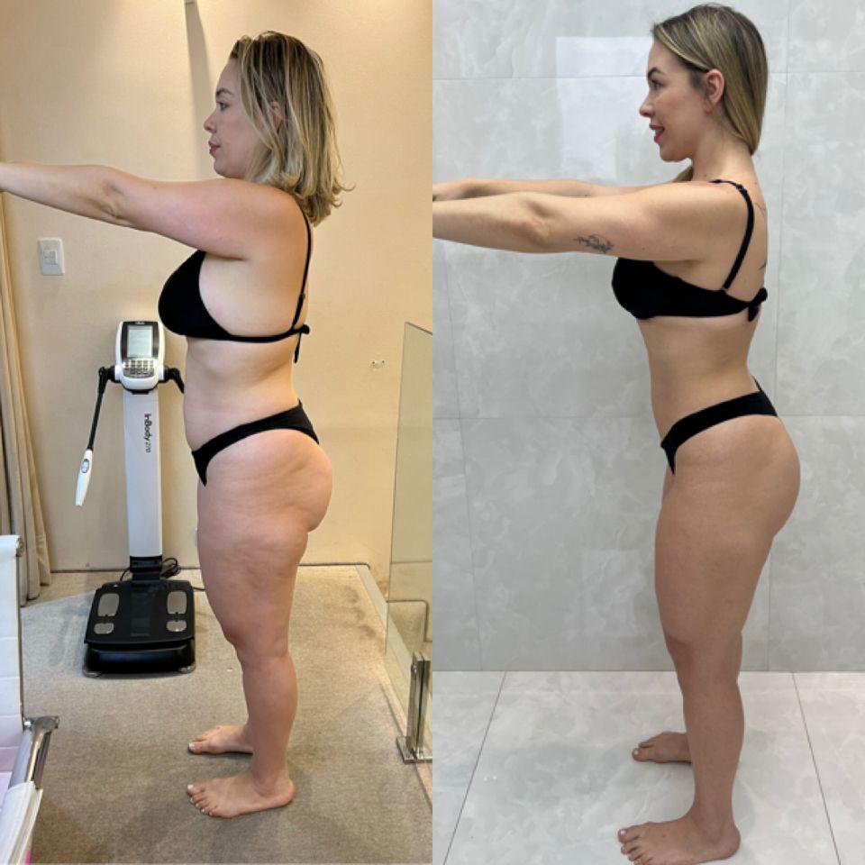 Resultado Paciente 1