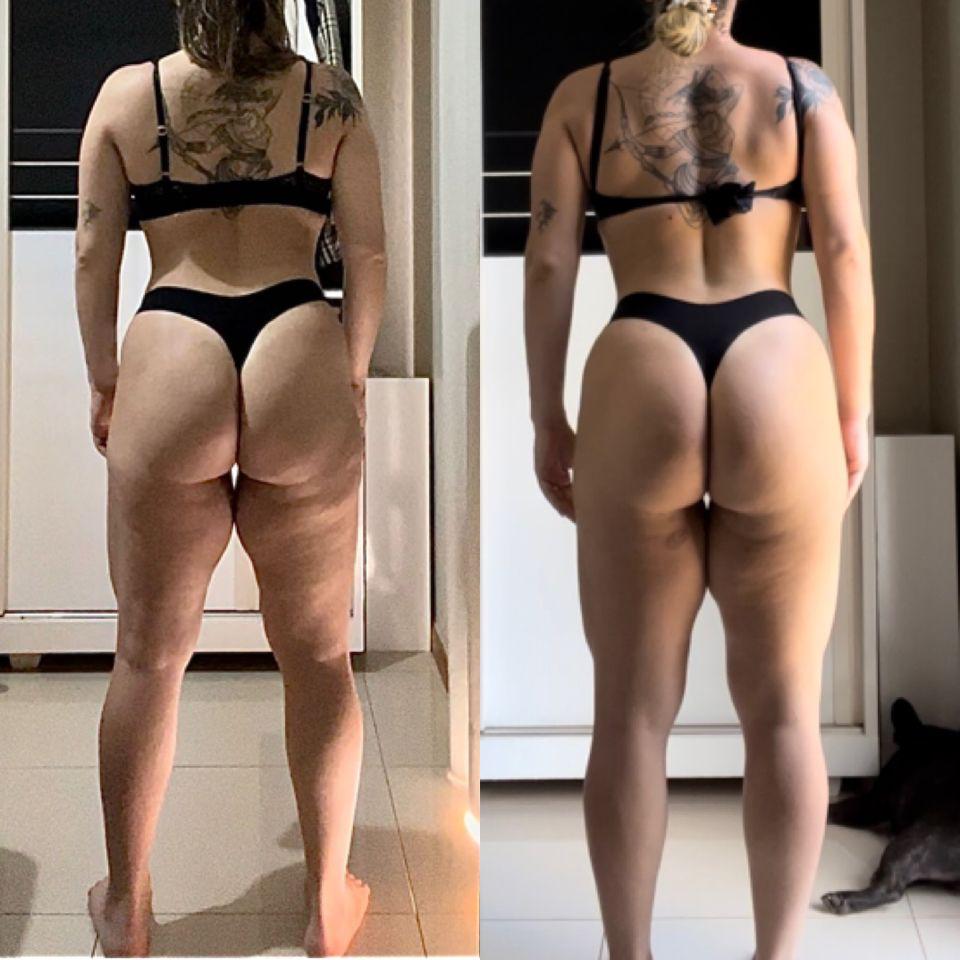 Resultado Paciente 5 (Oculto)